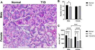 Topical naltrexone increases aquaporin 5 production in the lacrimal gland and restores tear production in diabetic rats